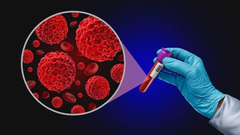 NHS England launches major prostate cancer research project involving 500000 men